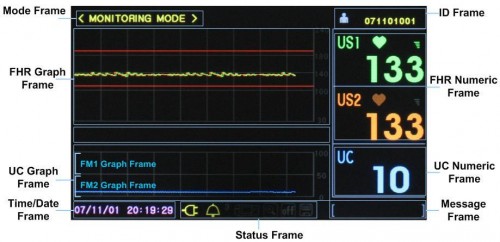 aparat ktg monitor 7"