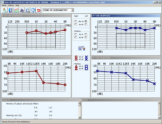Audiometr oprogramowanie SIBELSOND